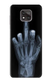 Motorola Moto G Power (2021) Hard Case X-ray Hand Middle Finger