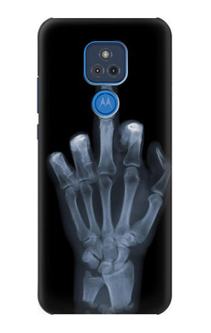 Motorola Moto G Play (2021) Hard Case X-ray Hand Middle Finger