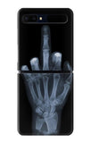 Samsung Galaxy Galaxy Z Flip 5G Hard Case X-ray Hand Middle Finger
