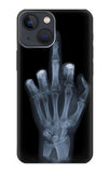 Apple iPhone 14 Hard Case X-ray Hand Middle Finger