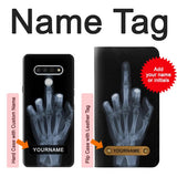 LG Stylo 6 Hard Case X-ray Hand Middle Finger with custom name