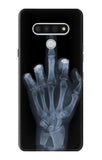 LG Stylo 6 Hard Case X-ray Hand Middle Finger