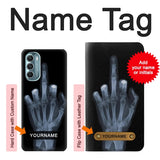 Motorola Moto G Stylus (2021), G Stylus 5G, G Stylus 5G (2022) Hard Case X-ray Hand Middle Finger with custom name