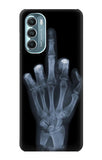 Motorola Moto G Stylus (2021), G Stylus 5G, G Stylus 5G (2022) Hard Case X-ray Hand Middle Finger