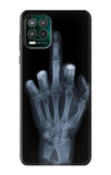 Motorola Moto G Stylus 5G Hard Case X-ray Hand Middle Finger