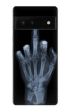 Google Pixel 6 Hard Case X-ray Hand Middle Finger