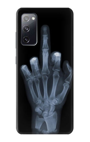 Samsung Galaxy S20 FE Hard Case X-ray Hand Middle Finger